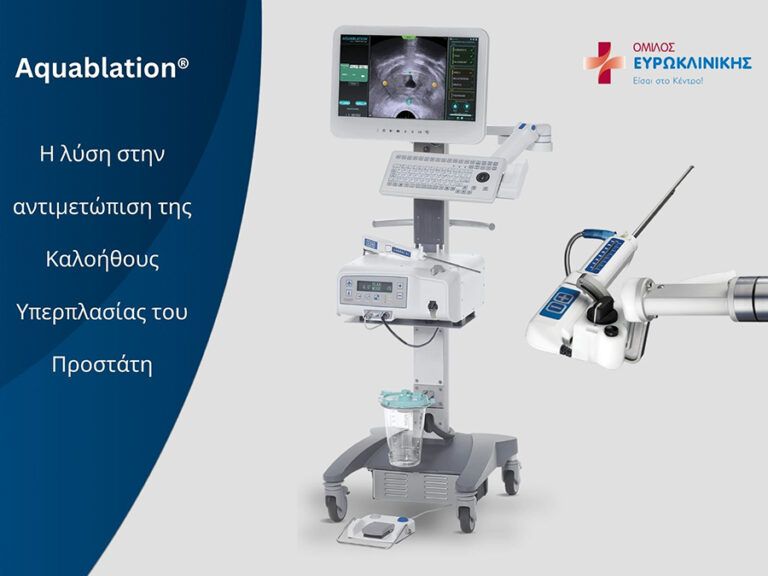 Όμιλος Ευρωκλινικής: Καινοτόμος ρομποτική θεραπεία Aquablation Όμιλος Ευρωκλινικής: Καινοτόμος ρομποτική θεραπεία Aquablation